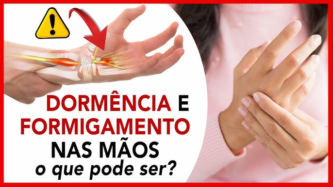 Dormência e Formigamento nas Mãos: Soluções e Orientações