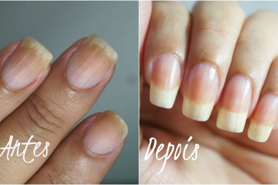 Como ter unhas grandes e fortes em 30 dias: receita caseira simples e eficaz